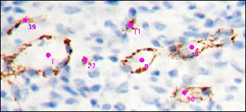 CD31 angiogenesis