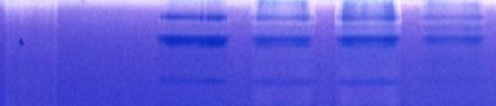 ability of dressings to regulate wound protease activity