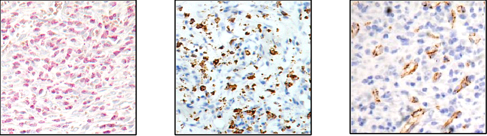 neutrophils chloroacetate esterase, macrophages ED-1, angiogenesis CD31 staining 
