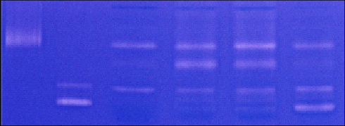 gelatin zymography of wound protease levels